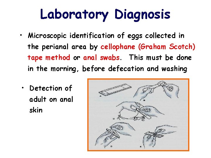 Enterobius vermicularis laboratory diagnosis, Diagnosis banding enterobiasis