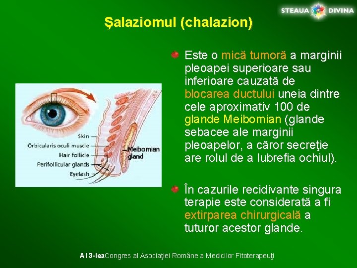 Şalaziomul (chalazion) Este o mică tumoră a marginii pleoapei superioare sau inferioare cauzată de