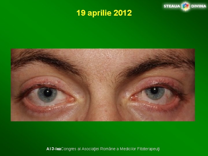 19 aprilie 2012 Al 3 -lea. Congres al Asociaţiei Române a Medicilor Fitoterapeuţi 