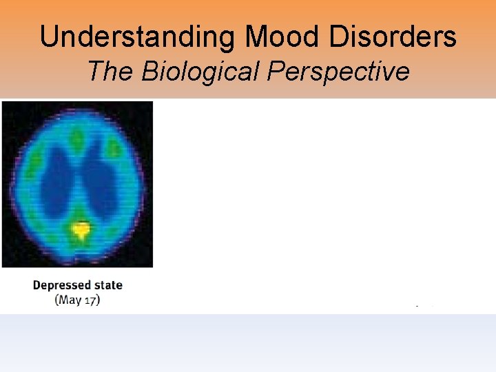 Understanding Mood Disorders The Biological Perspective 