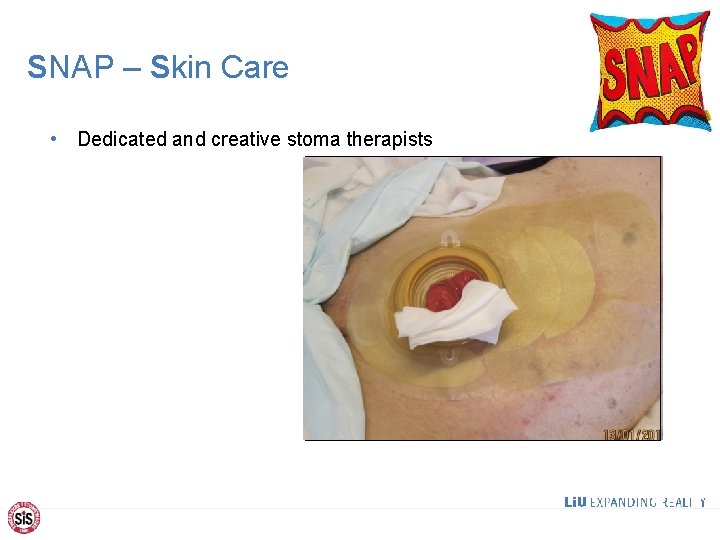 SNAP – Skin Care • Dedicated and creative stoma therapists 16 