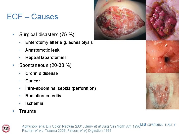 ECF – Causes • Surgical disasters (75 %) • Enterotomy after e. g. adhesiolysis
