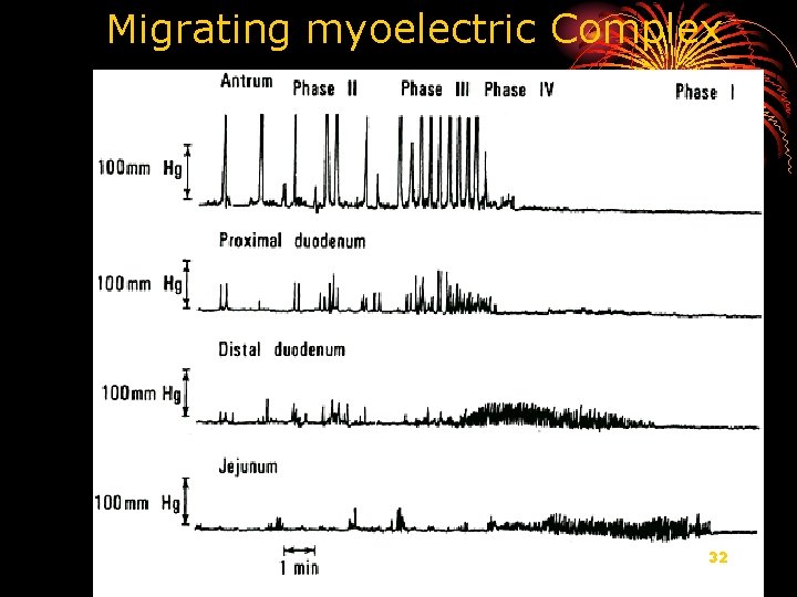 Migrating myoelectric Complex 32 