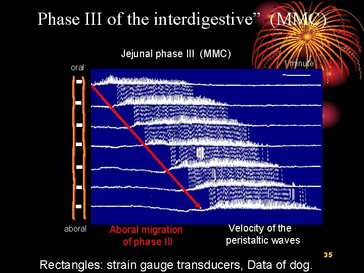 Phase III of the interdigestive” (MMC) Jejunal phase III (MMC) oral aboral Aboral migration