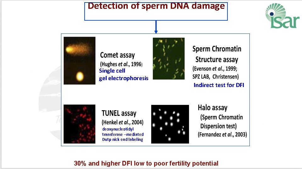 Detection of sperm DNA damage Single cell gel electrophoresis Indirect test for DFI deoxynucleotidyl