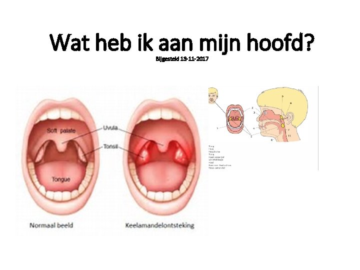 Wat heb ik aan mijn hoofd? Bijgesteld 13 -11 -2017 