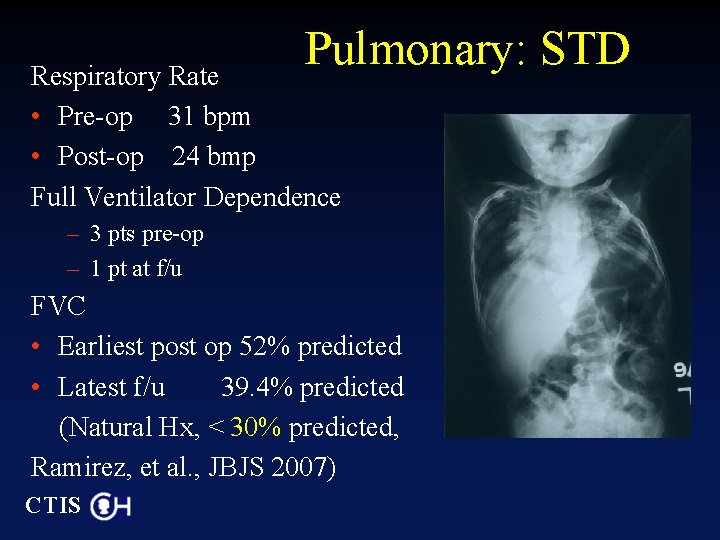 Pulmonary: STD Respiratory Rate • Pre-op 31 bpm • Post-op 24 bmp Full Ventilator