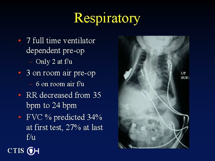 Respiratory • 7 full time ventilator dependent pre-op – Only 2 at f/u •