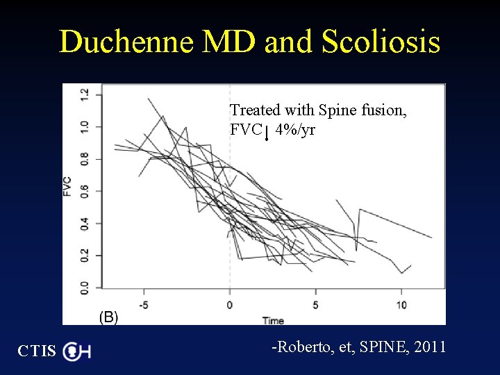 Duchenne MD and Scoliosis Treated with Spine fusion, FVC 4%/yr CTIS -Roberto, et, SPINE,