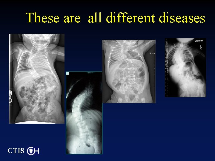These are all different diseases CTIS 