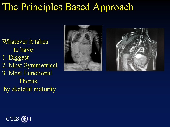 The Principles Based Approach Whatever it takes to have: 1. Biggest 2. Most Symmetrical