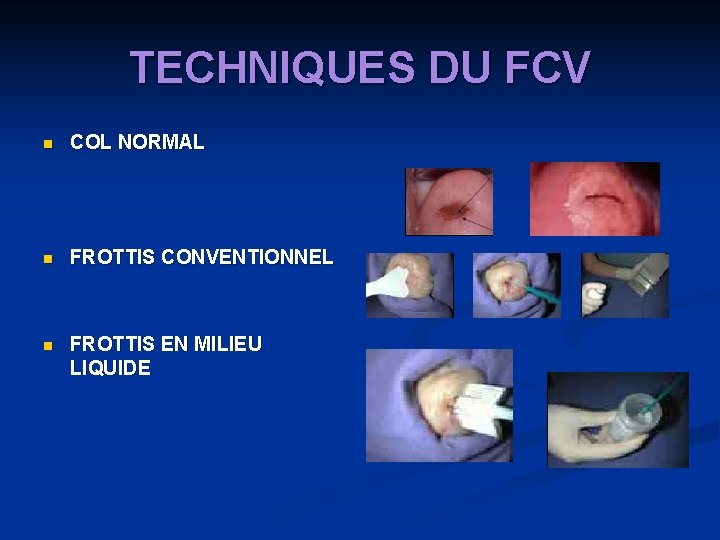 TECHNIQUES DU FCV n COL NORMAL n FROTTIS CONVENTIONNEL n FROTTIS EN MILIEU LIQUIDE