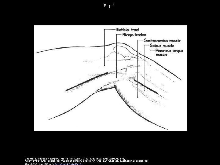 Fig. 1 Journal of Vascular Surgery 1987 6119 -123 DOI: (10. 1067/mva. 1987. avs