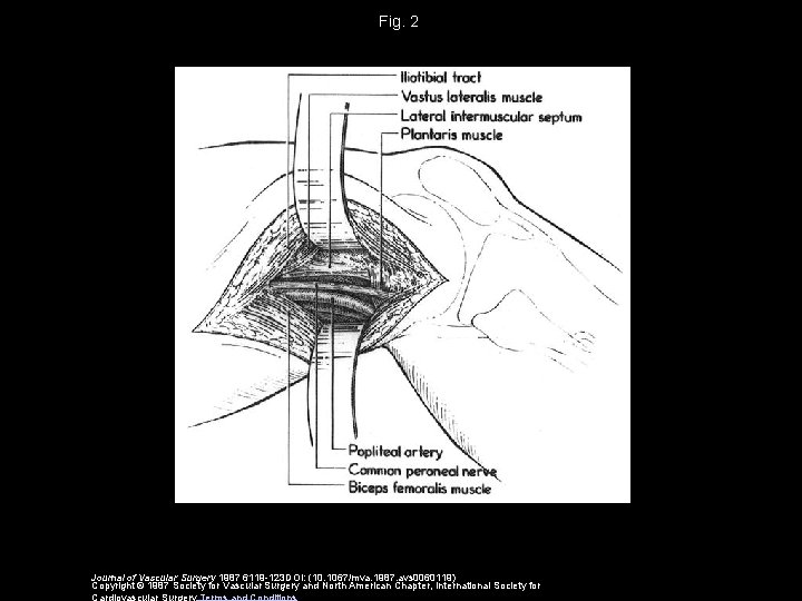 Fig. 2 Journal of Vascular Surgery 1987 6119 -123 DOI: (10. 1067/mva. 1987. avs