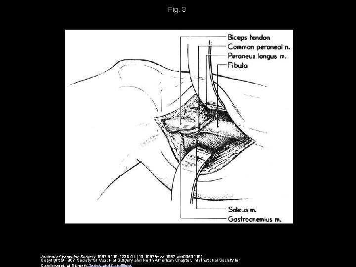 Fig. 3 Journal of Vascular Surgery 1987 6119 -123 DOI: (10. 1067/mva. 1987. avs