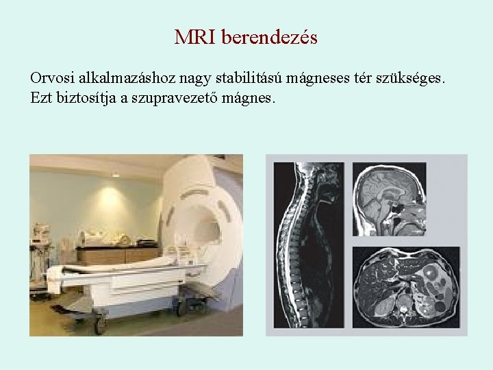 MRI berendezés Orvosi alkalmazáshoz nagy stabilitású mágneses tér szükséges. Ezt biztosítja a szupravezető mágnes.