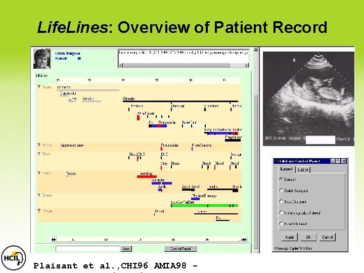 Life. Lines: Overview of Patient Record Plaisant et al. , CHI 96 AMIA 98 Life. Lines: Overview of Patient Record Plaisant et al. , CHI 96 AMIA 98