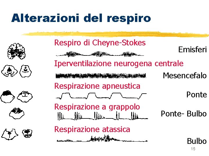 Alterazioni del respiro Respiro di Cheyne-Stokes Emisferi Iperventilazione neurogena centrale Mesencefalo Respirazione apneustica Ponte