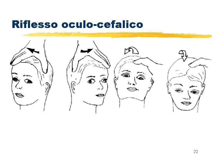 Riflesso oculo-cefalico 22 