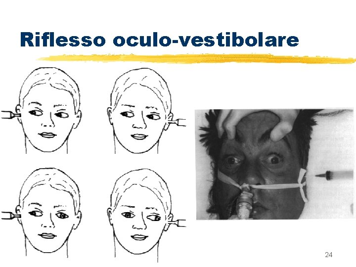 Riflesso oculo-vestibolare 24 