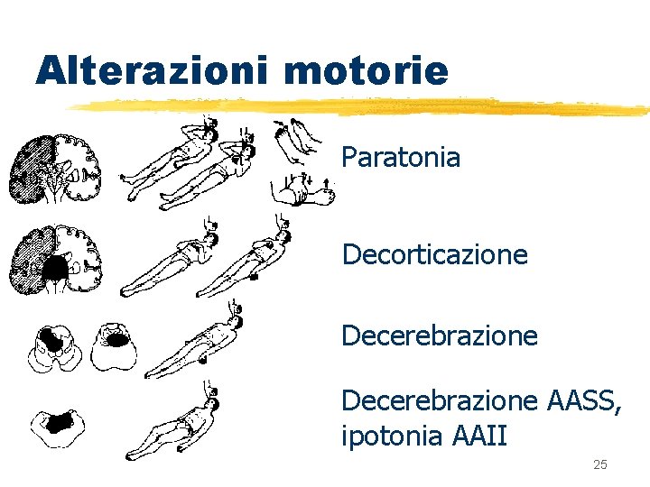 Alterazioni motorie Paratonia Decorticazione Decerebrazione AASS, ipotonia AAII 25 