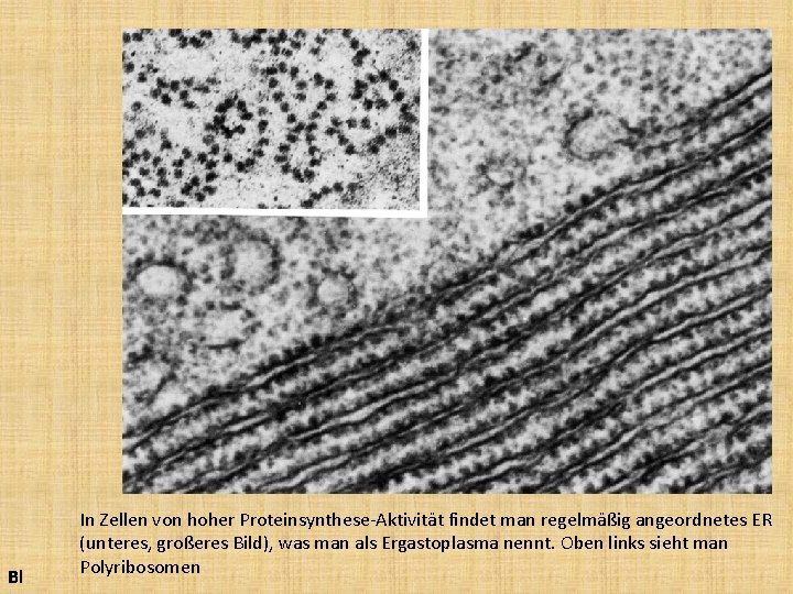 Bl In Zellen von hoher Proteinsynthese-Aktivität findet man regelmäßig angeordnetes ER (unteres, großeres Bild),