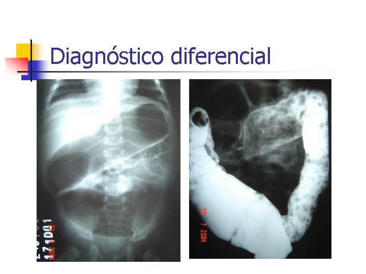 Diagnóstico diferencial 