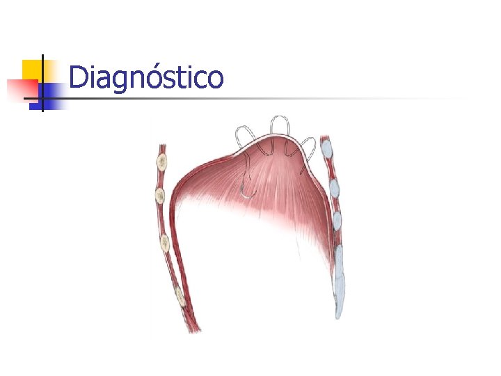 Diagnóstico 