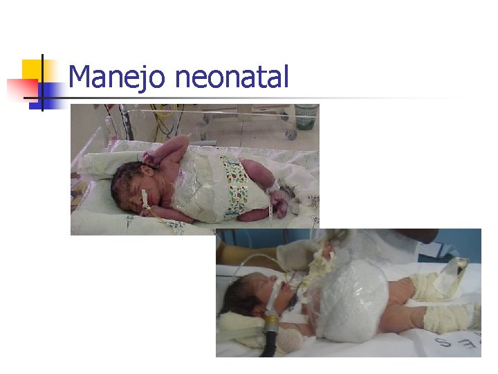 Manejo neonatal 