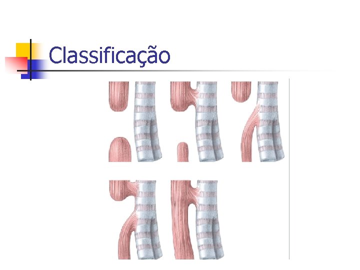 Classificação 