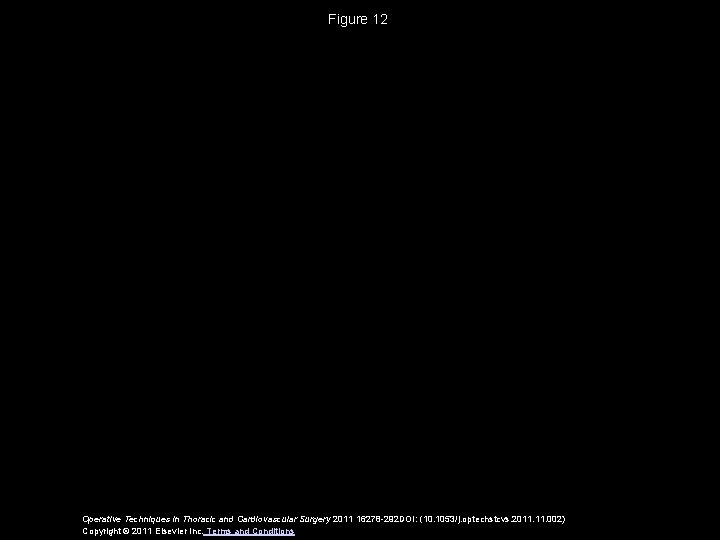 Figure 12 Operative Techniques in Thoracic and Cardiovascular Surgery 2011 16278 -292 DOI: (10.