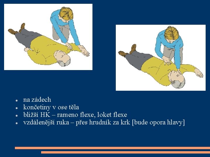  na zádech končetiny v ose těla bližší HK – rameno flexe, loket flexe