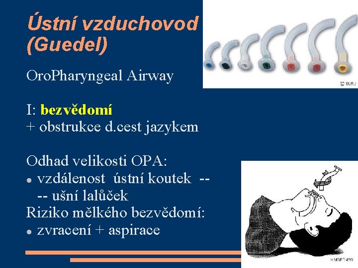 Ústní vzduchovod (Guedel) Oro. Pharyngeal Airway I: bezvědomí + obstrukce d. cest jazykem Odhad
