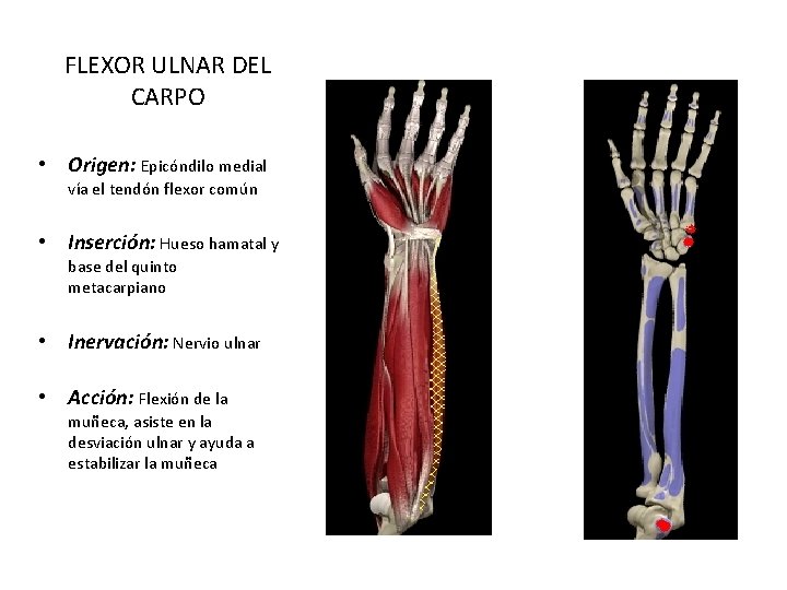 FLEXOR ULNAR DEL CARPO • Origen: Epicóndilo medial vía el tendón flexor común •