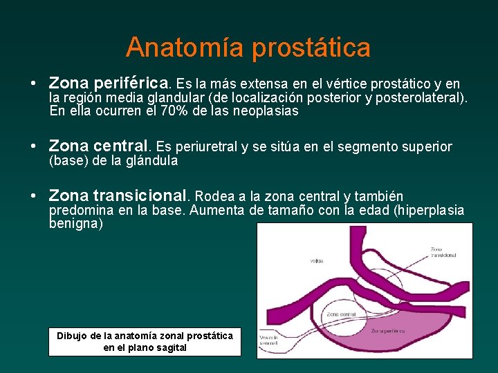 Anatomía prostática • Zona periférica. Es la más extensa en el vértice prostático y