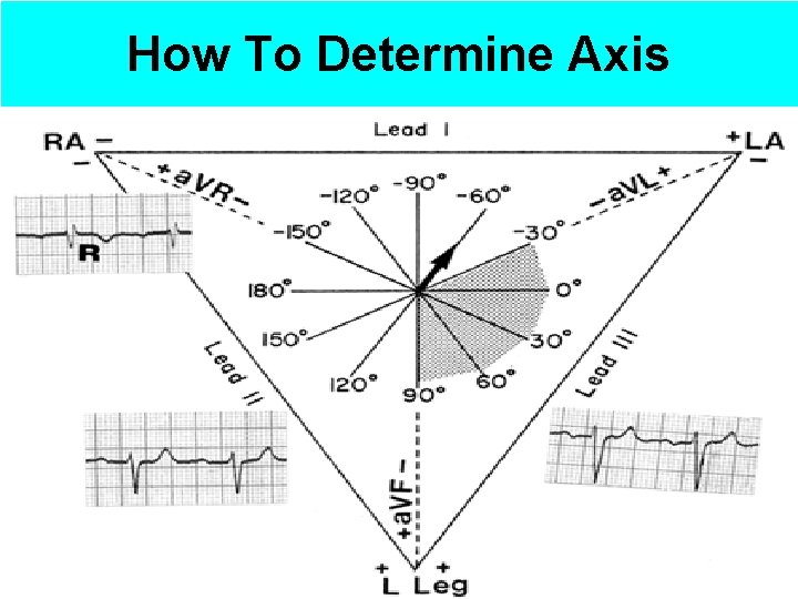 How To Determine Axis 