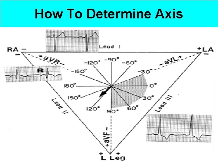 How To Determine Axis 