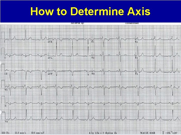 How to Determine Axis 