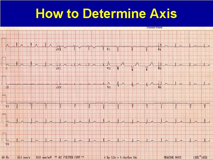 How to Determine Axis 