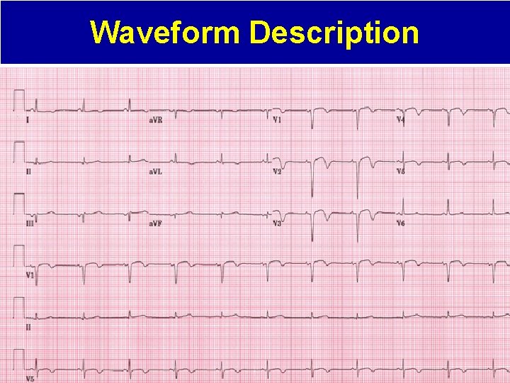 Waveform Description 