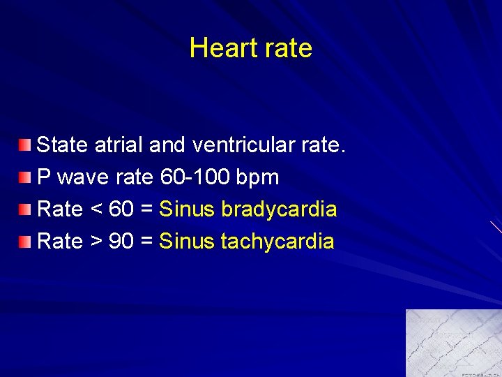 Heart rate State atrial and ventricular rate. P wave rate 60 -100 bpm Rate