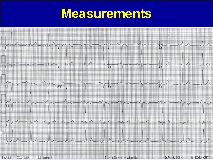 Measurements 