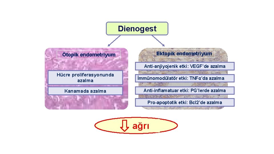 Dienogest Ektopik endometriyum Ötopik endometriyum Anti-anjiyojenik etki: VEGF’de azalma Hücre proliferasyonunda azalma Kanamada azalma
