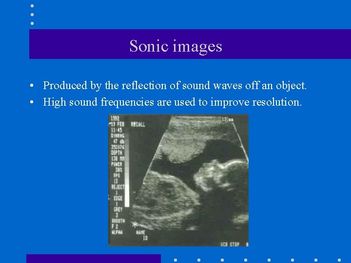 Sonic images • Produced by the reflection of sound waves off an object. •