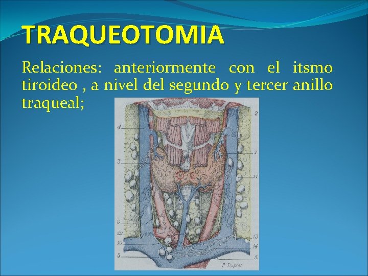 TRAQUEOTOMIA Relaciones: anteriormente con el itsmo tiroideo , a nivel del segundo y tercer