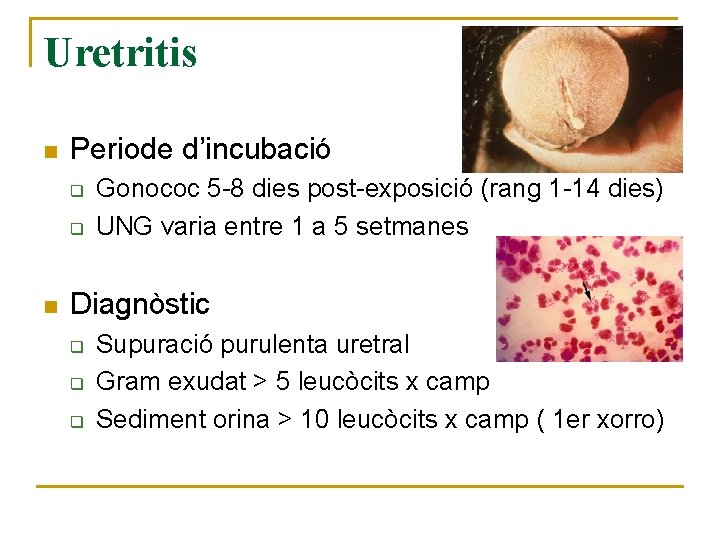 Uretritis n Periode d’incubació q q n Gonococ 5 -8 dies post-exposició (rang 1