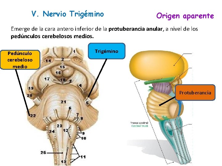 V. Nervio Trigémino Origen aparente Emerge de la cara antero inferior de la protuberancia V. Nervio Trigémino Origen aparente Emerge de la cara antero inferior de la protuberancia