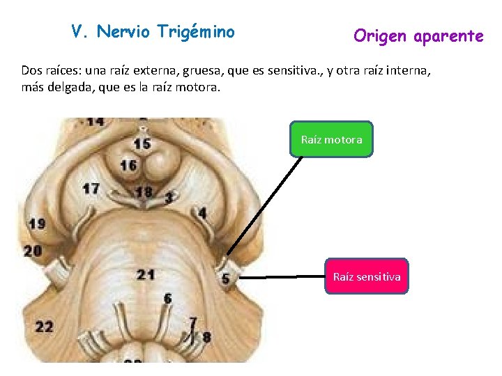 V. Nervio Trigémino Origen aparente Dos raíces: una raíz externa, gruesa, que es sensitiva.