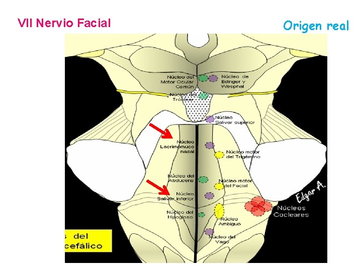 VII Nervio Facial Origen real 