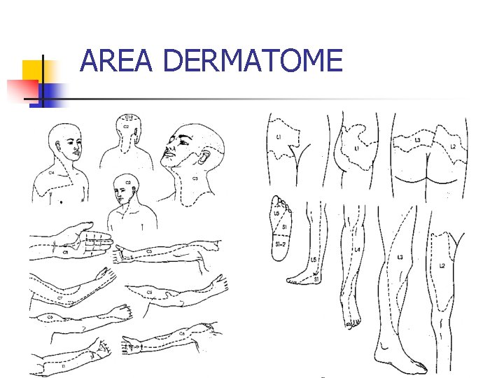 AREA DERMATOME 